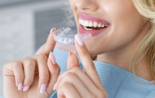 Clear Aligners Menifee