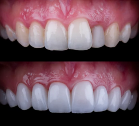 orthodontics menifee ca